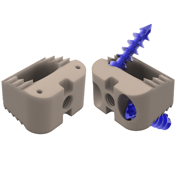 Romero implants